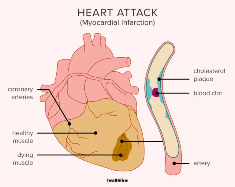 10 Main Reasons Of Heart Attacks